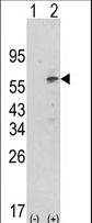 Western blot of PDK1 (arrow) using rabbit polyclonal hPDK1-G14. 293 cell lysates (2 ug/lane) either nontransfected (Lane 1) or transiently transfected with the PDK1 gene (Lane 2) (Origene Technologies).