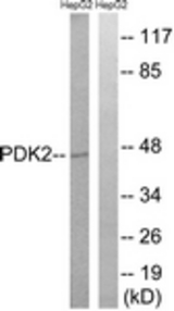 Western blot of extracts from HepG2 cells, using PDK2 Antibody. The lane on the right is treated with the synthesized peptide.