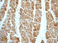 IHC of paraffin-embedded human muscles using anti-PDK2 antibody (cat# 2282-1).
