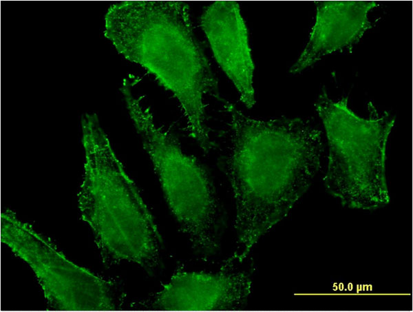 Immunofluorescence of monoclonal antibody to MGST3 on HeLa cell . [antibody concentration 10 ug/ml]