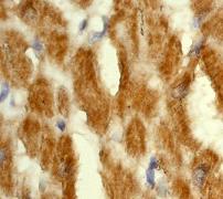 IHC of paraffin-embedded human heart muscle using anti-PDK2 antibody.