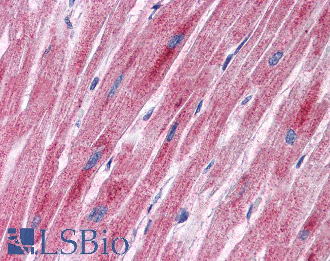 Anti-PDK2 antibody IHC of human heart. Immunohistochemistry of formalin-fixed, paraffin-embedded tissue after heat-induced antigen retrieval. Antibody LS-B5583 concentration 5 ug/ml.