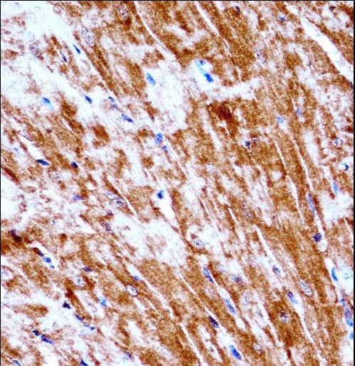 Mouse Pdk2 Antibody immunohistochemistry of formalin-fixed and paraffin-embedded mouse heart tissue followed by peroxidase-conjugated secondary antibody and DAB staining.