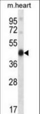 Mouse Pdk2 Antibody western blot of mouse heart tissue lysates (35 ug/lane). The Pdk2 antibody detected the Pdk2 protein (arrow).
