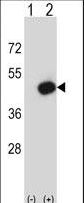 Western blot of Pdk2 (arrow) using rabbit polyclonal Mouse Pdk2 Antibody. 293 cell lysates (2 ug/lane) either nontransfected (Lane 1) or transiently transfected (Lane 2) with the Pdk2 gene.