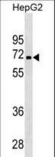 PDK3 Antibody western blot of HepG2 cell line lysates (35 ug/lane). The PDK3 antibody detected the PDK3 protein (arrow).