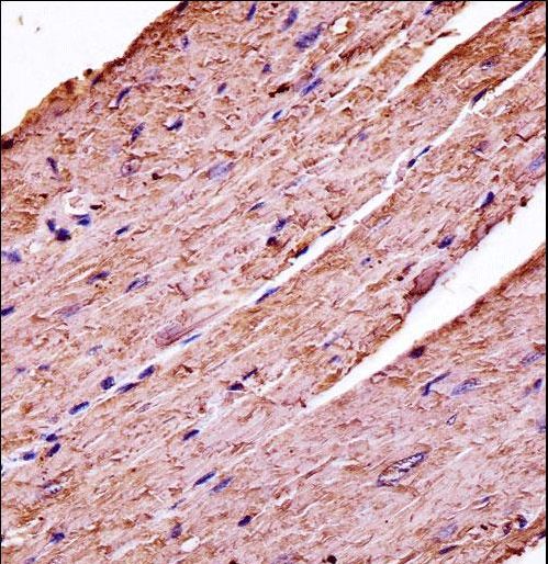 Mouse Pdk3 Antibody immunohistochemistry of formalin-fixed and paraffin-embedded mouse heart tissue followed by peroxidase-conjugated secondary antibody and DAB staining.