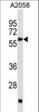 PDK3 Antibody (M1) western blot of A2058 cell line lysates (35 ug/lane). The PDK3 antibody detected the PDK3 protein (arrow).