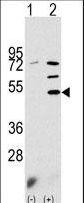 Western blot of PDK3 (arrow) using rabbit polyclonal PDK3 Antibody. 293 cell lysates (2 ug/lane) either nontransfected (Lane 1) or transiently transfected with the PDK3 gene (Lane 2) (Origene Technologies).