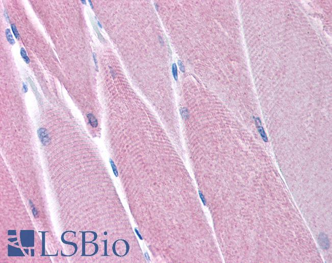 Anti-PDK4 antibody IHC of human skeletal muscle. Immunohistochemistry of formalin-fixed, paraffin-embedded tissue after heat-induced antigen retrieval. Antibody LS-B992 concentration 5 ug/ml.