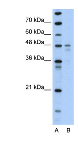 PDK4 antibody LS-B992 Western blot of Transfected 293T cell lysate.