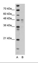 Transfected 293T Cell Lysate