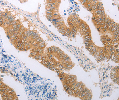 Immunohistochemistry of paraffin-embedded human colon tissue using PDK4 antibody.