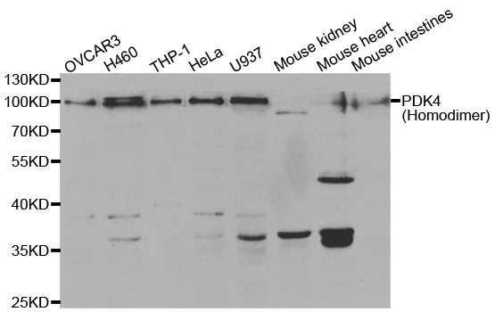 Western blot analysis of extracts of mouse pancreas cell lines, using PDK4 antibody.