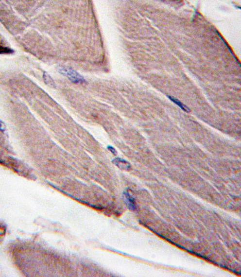 Formalin-fixed and paraffin-embedded human skeletal muscle tissue reacted with PDK4-E265, which was peroxidase-conjugated to the secondary antibody, followed by DAB staining. This data demonstrates the use of this antibody for immunohistochemistry; clinical relevance has not been evaluated.
