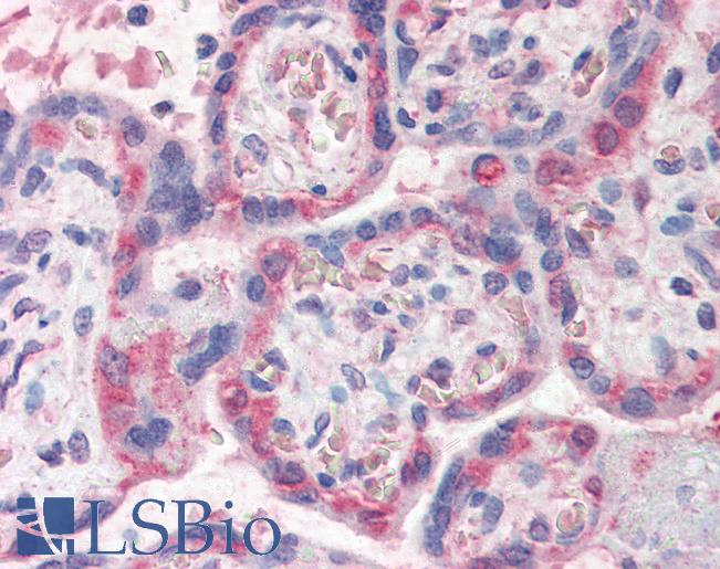 Anti-PDLIM1 antibody IHC of human placenta. Immunohistochemistry of formalin-fixed, paraffin-embedded tissue after heat-induced antigen retrieval. Antibody LS-B2418 concentration 5 ug/ml.