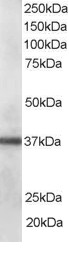 Antibody staining (0.1 ug/ml) of human lung lysate (RIPA buffer, 35 ug total protein per lane). Primary incubated for 1 hour. Detected by Western blot of chemiluminescence.