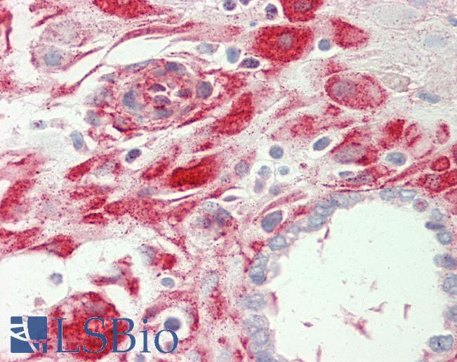 Anti-PDLIM1 antibody IHC staining of human placenta. Immunohistochemistry of formalin-fixed, paraffin-embedded tissue after heat-induced antigen retrieval. Antibody LS-B11094 dilution 1:100.