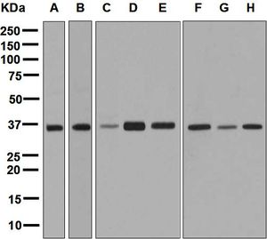 Western blot analysis on (A) human heart, (B) L6, (C) 293T, (D) Caco-2, (E) Saos-2, (F) C2C12, (G) rat lung, and (H) mouse lung lysates using anti-PDLIM1 antibody.