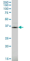 PDLIM1 monoclonal antibody (M02), clone 2D4. Western blot of PDLIM1 expression in Jurkat.