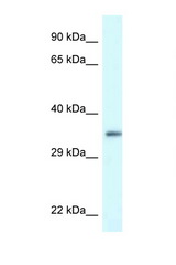 PDLIM1 antibody LS-C145329 Western blot of HeLa Cell lysate. Antibody concentration 1 ug/ml.
