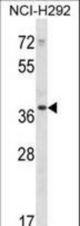 PDLIM1 Antibody western blot of NCI-H292 cell line lysates (35 ug/lane). The PDLIM1 antibody detected the PDLIM1 protein (arrow).