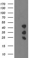 HEK293T cells were transfected with the pCMV6-ENTRY control (Left lane) or pCMV6-ENTRY PDLIM2 (Right lane) cDNA for 48 hrs and lysed. Equivalent amounts of cell lysates (5 ug per lane) were separated by SDS-PAGE and immunoblotted with anti-PDLIM2.