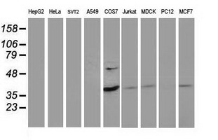 Western blot of extracts (35 ug) from 9 different cell lines by using anti-PDLIM2 monoclonal antibody.
