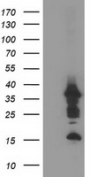 HEK293T cells were transfected with the pCMV6-ENTRY control (Left lane) or pCMV6-ENTRY PDLIM2 (Right lane) cDNA for 48 hrs and lysed. Equivalent amounts of cell lysates (5 ug per lane) were separated by SDS-PAGE and immunoblotted with anti-PDLIM2.