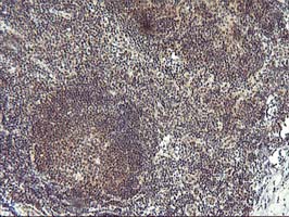 IHC of paraffin-embedded Human tonsil using anti-PDLIM2 mouse monoclonal antibody. (Heat-induced epitope retrieval by 10mM citric buffer, pH6.0, 100C for 10min).
