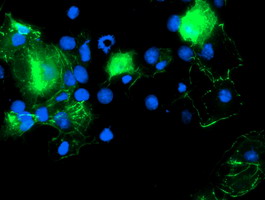 Anti-PDLIM2 mouse monoclonal antibody immunofluorescent staining of COS7 cells transiently transfected by pCMV6-ENTRY PDLIM2.