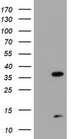 HEK293T cells were transfected with the pCMV6-ENTRY control (Left lane) or pCMV6-ENTRY PDLIM2 (Right lane) cDNA for 48 hrs and lysed. Equivalent amounts of cell lysates (5 ug per lane) were separated by SDS-PAGE and immunoblotted with anti-PDLIM2.