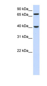 PDLIM3 antibody LS-C102580 Western blot of Fetal Liver lysate.