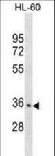 PDLIM3 Antibody western blot of HL-60 cell line lysates (35 ug/lane). The PDLIM3 antibody detected the PDLIM3 protein (arrow).