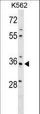 PDLIM4 Antibody western blot of K562 cell line lysates (35 ug/lane). The PDLIM4 antibody detected the PDLIM4 protein (arrow).
