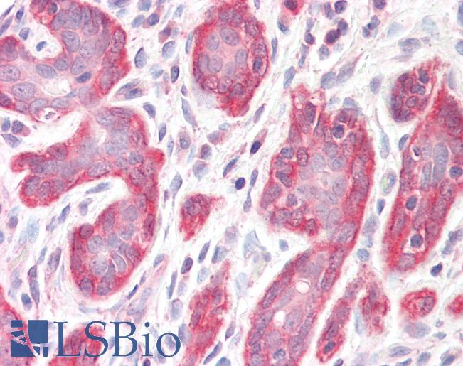 Anti-PDLIM4 / RIL antibody IHC staining of human breast. Immunohistochemistry of formalin-fixed, paraffin-embedded tissue after heat-induced antigen retrieval.