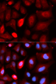 Immunofluorescence analysis of U20S cell using PDLIM5 antibody. Blue: DAPI for nuclear staining.