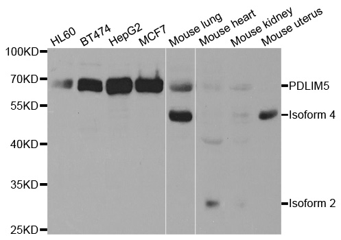 Western blot analysis of extracts of various cell lines, using PDLIM5 antibody.