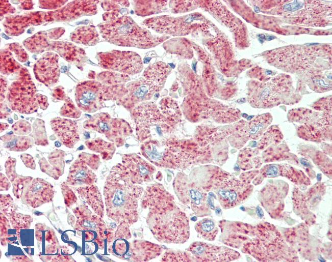 Anti-PDLIM5 / LIM antibody IHC staining of human heart. Immunohistochemistry of formalin-fixed, paraffin-embedded tissue after heat-induced antigen retrieval. Antibody LS-B11243 dilution 1:100.