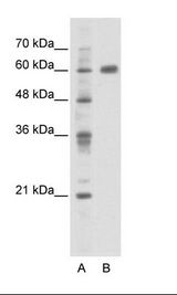 A: Marker, B: HepG2 Cell Lysate