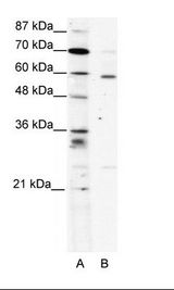A: Marker, B: HepG2 Cell Lysate