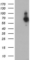 HEK293T cells were transfected with the pCMV6-ENTRY control (Left lane) or pCMV6-ENTRY PDLIM5 (Right lane) cDNA for 48 hrs and lysed. Equivalent amounts of cell lysates (5 ug per lane) were separated by SDS-PAGE and immunoblotted with anti-PDLIM5.