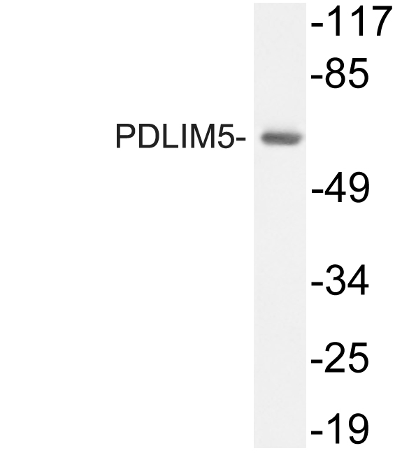 Western blot of PDLIM5 (S257) pAb in extracts from A549 cells.
