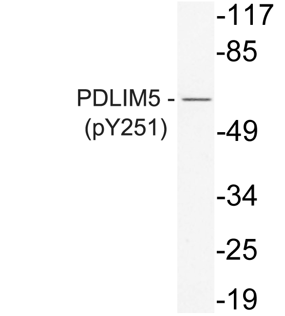 Western blot of p-CD318 (Y707) pAb in extracts from K562 cells.