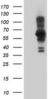 HEK293T cells were transfected with the pCMV6-ENTRY control (Left lane) or pCMV6-ENTRY PDLIM5 (Right lane) cDNA for 48 hrs and lysed. Equivalent amounts of cell lysates (5 ug per lane) were separated by SDS-PAGE and immunoblotted with anti-PDLIM5.