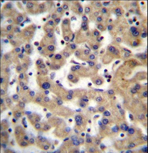PDP1 Antibody immunohistochemistry of formalin-fixed and paraffin-embedded human liver tissue followed by peroxidase-conjugated secondary antibody and DAB staining.