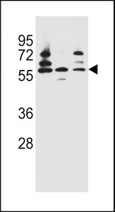 PDP1 Antibody western blot of Jurkat,HepG2,293 cell line lysates (35 ug/lane). The PDP1 antibody detected the PDP1 protein (arrow).
