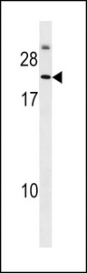 Western blot of anti-T1A-2 antibody in NCI-H460 cell lysate. T1A-2 (Arrow) was detected using purified antibody. Secondary HRP-anti-rabbit was used for signal visualization with chemiluminescence.