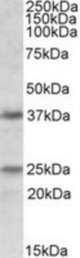 PDPN antibody (1 ug/ml) staining of Human Cerebellum lysate (35 ug protein in RIPA buffer). Primary incubation was 1 hour. Detected by chemiluminescence.