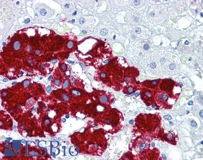 Anti-Podoplanin antibody IHC of human adrenal. Immunohistochemistry of formalin-fixed, paraffin-embedded tissue after heat-induced antigen retrieval. Antibody LS-B5782 concentration 5 ug/ml.